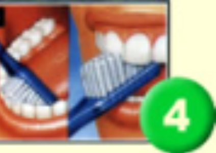 dientes 4